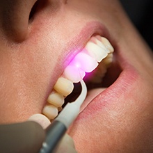 soft tissue laser on smile