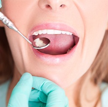 close up of woman's smile with tooth-colored fillings