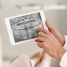 dentist pointing to x-ray on tablet